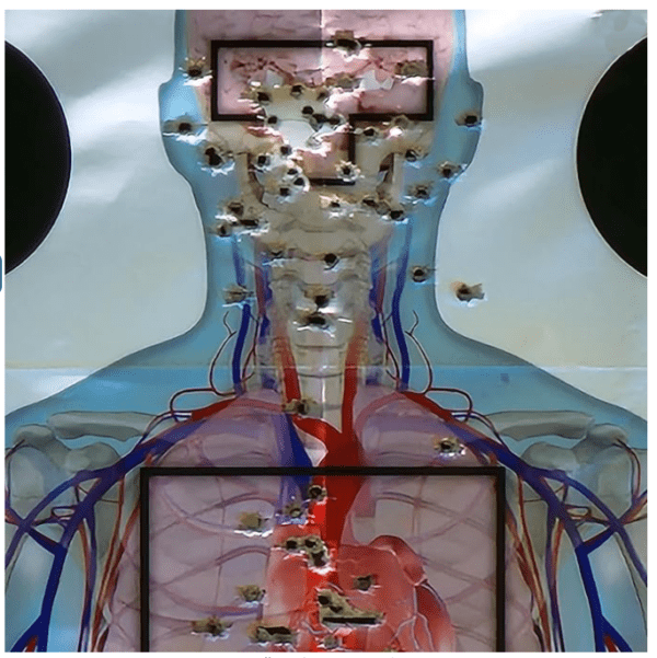 Anatomical Target - Image 3